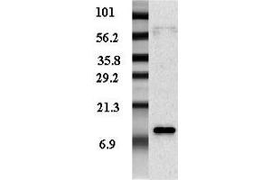 Western blot analysis of adipocyte-conditioned medium from human male and female with different expression levels using anti-Resistin (human), pAb . (Resistin 抗体)