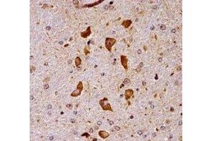 Pak7 antibody immunohistochemistry analysis in formalin fixed and paraffin embedded mouse brain tissue. (PAK7 抗体  (AA 128-157))