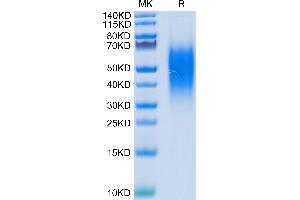 SDS-PAGE (SDS) image for V-Set Domain Containing T Cell Activation Inhibitor 1 (VTCN1) (AA 33-194) protein (His tag) (ABIN7273954)