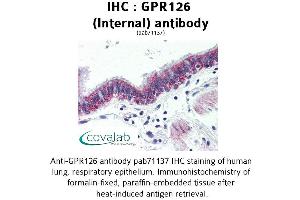Image no. 2 for anti-G Protein-Coupled Receptor 126 (GPR126) (Internal Region) antibody (ABIN1734924) (G Protein-Coupled Receptor 126 抗体  (Internal Region))