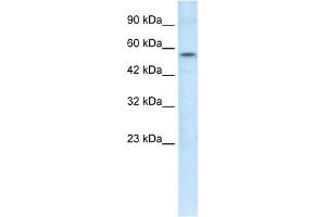 WB Suggested Anti-ETS1 Antibody Titration:  1. (ETS1 抗体  (N-Term))