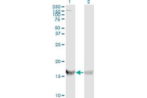 Western Blot analysis of RPS19 expression in transfected 293T cell line by RPS19 monoclonal antibody (M01A), clone 3C6. (RPS19 抗体  (AA 1-145))