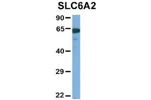 Western Blotting (WB) image for anti-Solute Carrier Family 6 (Neurotransmitter Transporter, Noradrenalin), Member 2 (SLC6A2) (Middle Region) antibody (ABIN2777051)