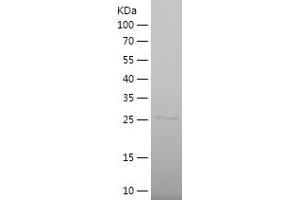 Western Blotting (WB) image for NQO2 (NQO2) (AA 1-231) protein (His tag) (ABIN7124196) (NQO2 Protein (NQO2) (AA 1-231) (His tag))