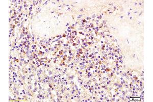 Immunohistochemistry (IHC) image for anti-Sema Domain, Immunoglobulin Domain (Ig), Transmembrane Domain (TM) and Short Cytoplasmic Domain, (Semaphorin) 4D (SEMA4D) (AA 75-170) antibody (ABIN1387543)