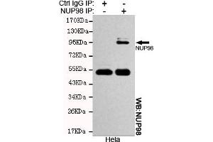 Immunoprecipitation analysis of Hela cell lysates using NUP98 mouse mAb. (NUP98 抗体)