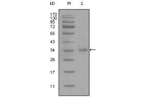 Western blot analysis using anti-CD45 monoclonal antibody against truncated CD45 recombinant protein (1). (CD45 抗体)