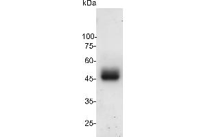 SDS-PAGE (SDS) image for SARS-CoV-2 Spike (SARS-CoV-2 S) (B.1.617.2 - delta), (RBD) protein (His-SUMO Tag) (ABIN7884572)