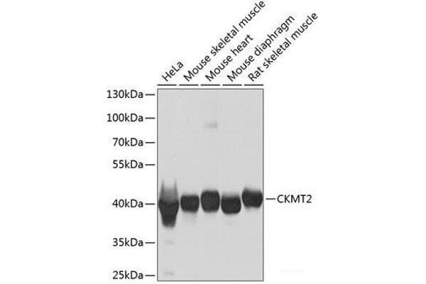 CKMT2 抗体