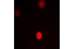 Immunofluorescent analysis of CTBP1 staining in HeLa cells. (CTBP1 抗体  (C-Term))