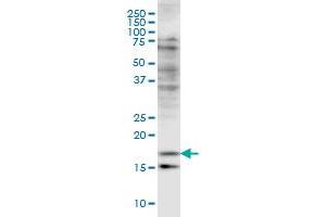 CFL2 monoclonal antibody (M03), clone 6G9 Western Blot analysis of CFL2 expression in HeLa . (Cofilin 2 抗体  (AA 57-166))