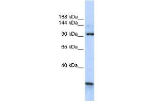 Western Blotting (WB) image for anti-KIAA1024 (KIAA1024) antibody (ABIN2459070) (KIAA1024 抗体)