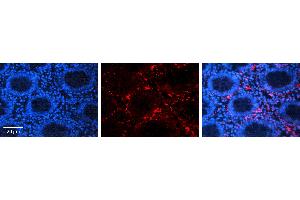 Immunohistochemistry (IHC) image for anti-Actin, beta (ACTB) (Middle Region) antibody (ABIN2778644)