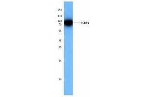 Western Blotting (WB) image for anti-Structure Specific Recognition Protein 1 (SSRP1) antibody (ABIN2666367) (SSRP1 抗体)