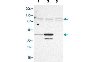 Western blot analysis of Lane 1: RT-4, Lane2: U-251MG sp, Lane 3: Human cell line A-431 with SLMAP polyclonal antibody . (SLMAP 抗体)