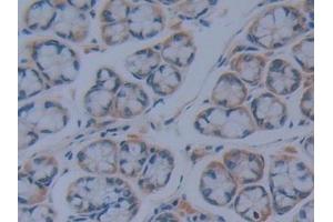 Detection of IkBd in Mouse Intestine Tissue using Polyclonal Antibody to Inhibitory Subunit Of NF Kappa B Delta (IkBd) (IkBd 抗体  (AA 58-304))