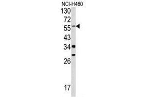 Western blot analysis of YAP1 antibody (C-term) in NCI-H460 cell line lysates (35ug/lane). (YAP1 抗体  (C-Term))