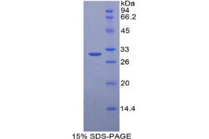SDS-PAGE analysis of Mouse HGD Protein. (HGD 蛋白)