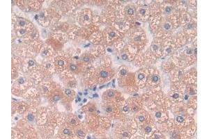 Detection of C9 in Human Liver Tissue using Polyclonal Antibody to Complement Component 9 (C9) (C9 抗体  (AA 22-265))