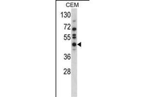 Western blot analysis of USP12 Antibody (N-term) (ABIN388898 and ABIN2839184) in CEM cell line lysates (35 μg/lane). (USP12 抗体  (N-Term))