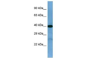 Western Blotting (WB) image for anti-Twinfilin, Actin-Binding Protein, Homolog 2 (Drosophila) (TWF2) (C-Term) antibody (ABIN2784884) (TWF2 抗体  (C-Term))