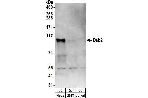 anti-Disabled Homolog 2, Mitogen-Responsive phosphoprotein (Drosophila) (DAB2) (AA 275-325) antibody