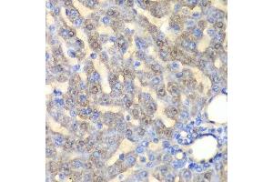 Immunohistochemistry of paraffin-embedded rat liver using FAH antibody. (FAH 抗体  (AA 1-419))