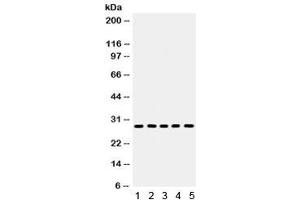 Western blot testing of 1) rat kidney, 2) rat lung, 3) rat heart, 4) rat PC-12 and 5) mouse HEPA lysate with Aquaporin 1 antibody. (Aquaporin 1 抗体)