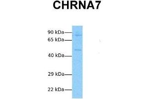 Host:  Rabbit  Target Name:  CHRNA7  Sample Tissue:  Human Jurkat  Antibody Dilution:  1. (CHRNA7 抗体  (N-Term))
