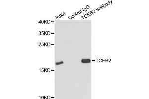 Immunoprecipitation analysis of 150ug extracts of MCF7 cells using 3ug TCEB2 antibody. (TCEB2 抗体)