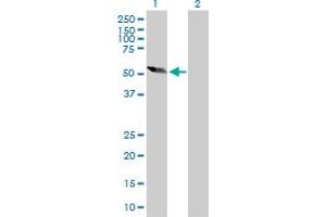Western Blot analysis of DPH2 expression in transfected 293T cell line by DPH2 MaxPab polyclonal antibody. (DPH2 抗体  (AA 1-489))