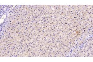 Detection of TFR in Human Liver Tissue using Monoclonal Antibody to Transferrin Receptor (TFR) (Transferrin Receptor 抗体  (AA 567-744))