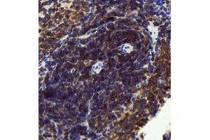 Immunohistochemistry of paraffin embedded rat spleen using CCR2 (ABIN7073453) at dilution of 1:1500 (400x lens) (CCR2 抗体)