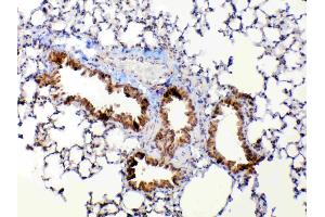 IHC analysis of MMP13 using anti-MMP13 antibody . (MMP13 抗体  (AA 99-335))