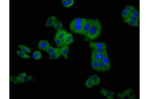 Immunofluorescence staining of HepG2 cells with ABIN7147581 at 1:100, counter-stained with DAPI.
