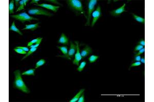 Immunofluorescence of purified MaxPab antibody to MX1 on HeLa cell. (MX1 抗体  (AA 1-662))