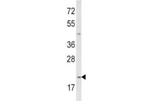 Western Blotting (WB) image for anti-Interleukin 12 (IL12) (AA 168-195) antibody (ABIN3031445)