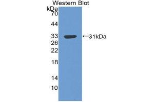 Detection of Recombinant C4BPb, Human using Polyclonal Antibody to C4 Binding Protein Beta (C4BPb) (C4BPB 抗体  (AA 18-252))