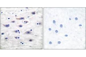Immunohistochemistry analysis of paraffin-embedded human brain tissue, using GluR1 (Ab-863) Antibody. (Glutamate Receptor 1 抗体  (AA 829-878))