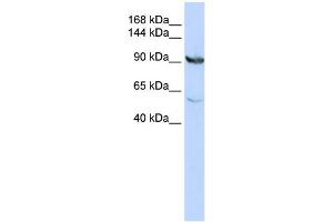 Western Blotting (WB) image for anti-Methylenetetrahydrofolate Dehydrogenase (NADP+ Dependent) 1, Methenyltetrahydrofolate Cyclohydrolase, Formyltetrahydrofolate Synthetase (MTHFD1) (N-Term) antibody (ABIN2782514)