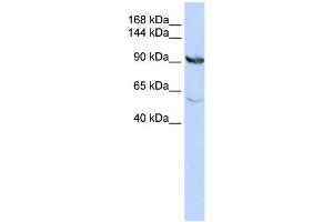 WB Suggested Anti-MTHFD1 Antibody Titration:  0. (MTHFD1 抗体  (N-Term))