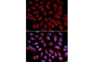 Immunofluorescence analysis of U2OS cell using AIFM1 antibody. (AIF 抗体  (AA 334-613))