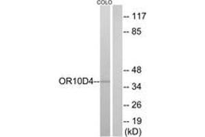 Western blot analysis of extracts from COLO cells, using OR10D4 Antibody. (OR10D4P 抗体  (AA 161-210))