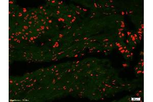 Formalin-fixed and paraffin-embedded human colon carcinoma labeled with Anti-DATF1/IDO1 Polyclonal Antibody, Unconjugatedused at 1:200 dilution for 40 minutes at 37°C (IDO1 抗体  (AA 1-100))