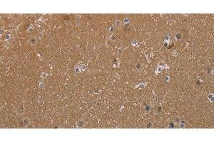 Immunohistochemistry of paraffin-embedded Human brain tissue using MAGEL2 Polyclonal Antibody at dilution 1:40 (MAGE-Like 2 抗体)