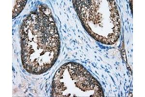 Immunohistochemical staining of paraffin-embedded Kidney tissue using anti-DNTTIP1 mouse monoclonal antibody. (DNTTIP1 抗体)