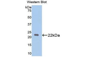 Western blot analysis of the recombinant protein. (PARK7/DJ1 抗体  (AA 1-189))