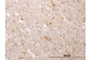 Immunostaining (ISt) image for anti-ATPase, Ca++ Transporting, Cardiac Muscle, Fast Twitch 1 (ATP2A1) (AA 522-612) antibody (ABIN559993)