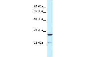 WB Suggested Anti-Yipf5 Antibody   Titration: 1. (YIPF5 抗体  (N-Term))