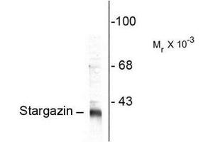 Image no. 1 for anti-Calcium Channel, Voltage-Dependent, gamma Subunit 2 (CACNG2) (C-Term) antibody (ABIN372715) (Stargazin 抗体  (C-Term))